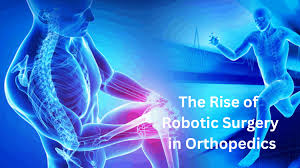 Robotic Orthopedic Surgery in Kabirdham