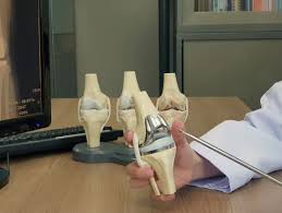 Robotic Joint Replacement in Janjgir-Champa