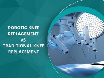 Robotic knee replacement in yavatmal
