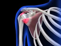 Rotator Cuff Surgeon In Narsinghpur