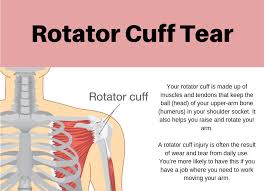Rotator Cuff Surgeon In Rewa