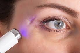 Scar Treatment in Nagpur
