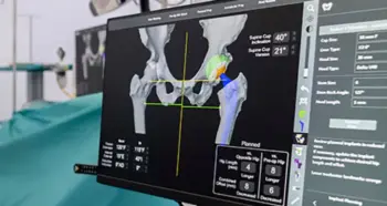 Surgical planning information