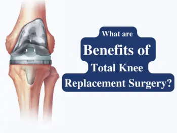 Total knee replacement
