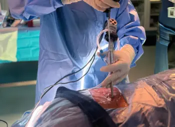 minimized tissue trauma