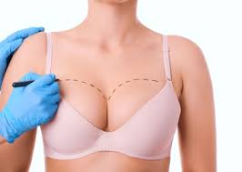Breast Augmentation in Surguja