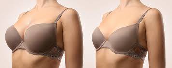 Breast augmentation in Betul