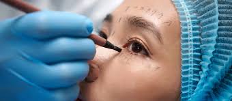Cosmetic Surgery in Korea