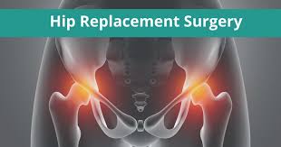 Hip Replacement Surgery In Betul