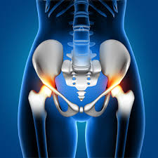 Robotic Hip Replacement in Surguja