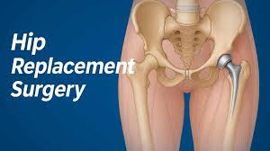 Hip replacement surgery in Panna