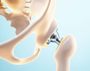 Hip replacement surgery in bhandara