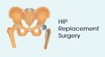 Hip Replacement Surgery in Buldhana