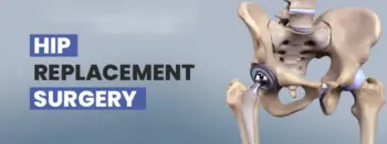 Hip replacement surgery in washim