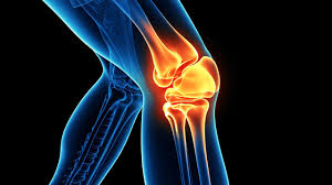 Joint pain treatment in Datia