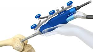 Knee Replacement Surgery in Narayanpur