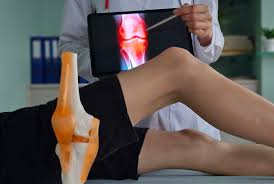 Knee replacement surgery in Khargone
