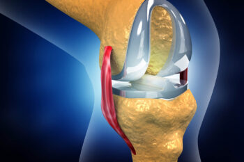 Knee replacement surgery in washim