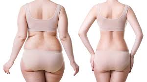 Liposuction In Itarsi