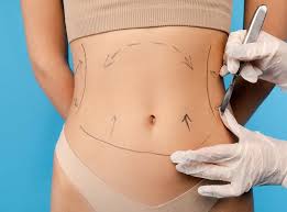 Liposuction In Panna