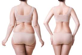 Liposuction in Korea