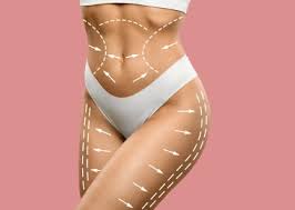 Liposuction in Sukma