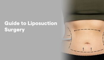 Liposuction in washim