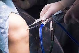 Orthopedic Surgeon in Sakti