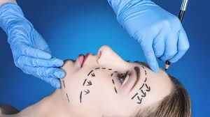 Plastic Surgery in Narayanpur