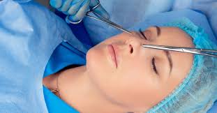 Rhinoplasty in Surguja