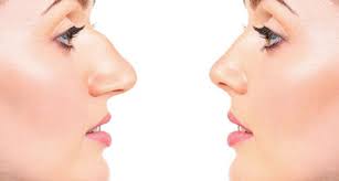 Liposuction in Surguja