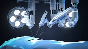Robotic Assisted Surgery in Rajnandgaon