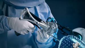 Robotic Knee Replacement In Datia