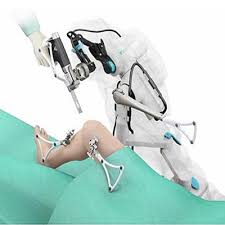 Robotic Knee Replacement in Surguja
