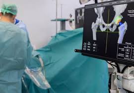 Robotic hip replacement in Nagda