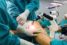 Robotic knee replacement in Narsinghpur