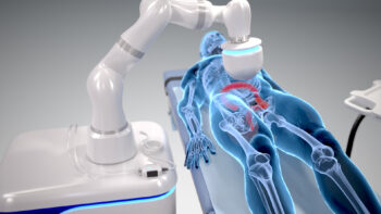 Robotic orthopedic surgery in adilabad