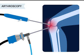 Outpatient arthroscopy benefits in Nagpur