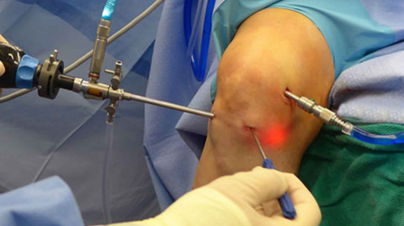 Best Arthroscopy Specialist Doctor In Gondia