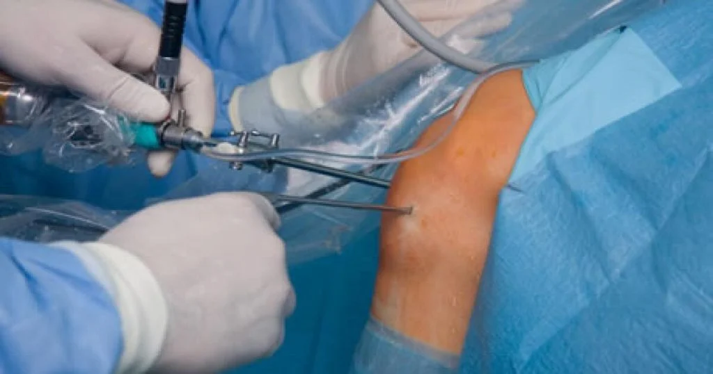 Best Arthroscopy Specialist Doctor In Seoni