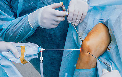 Best Knee Ligament Surgeon In Rewa
