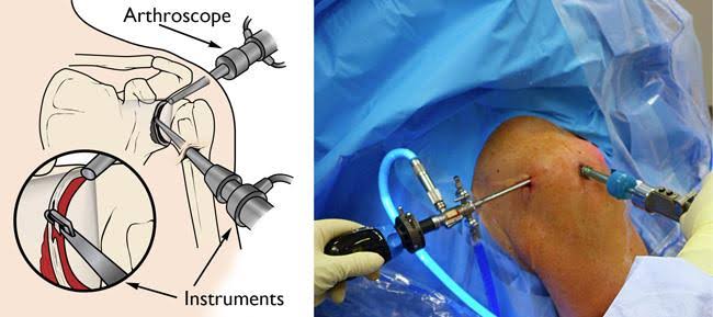 Best Shoulder Surgeon In Nagpur