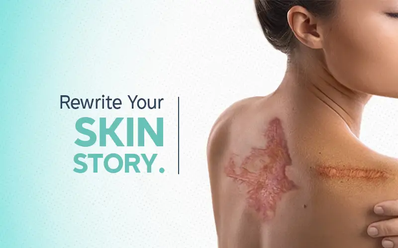 Burn Scar Correction In Nagpur