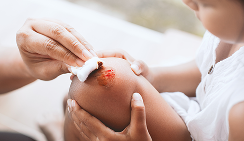 Chronic Wound Treatment In Nagpur