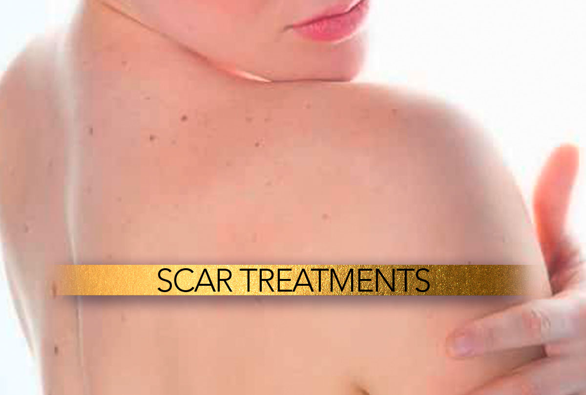 Cosmetic scar management in nagpur