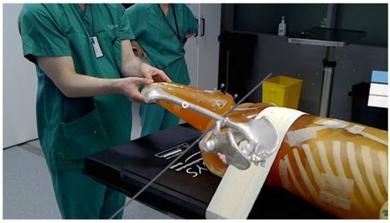 Custom surgical planning in Nagpur