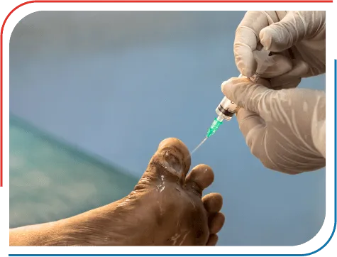 Diabetic Foot Treatment In Nagpur
