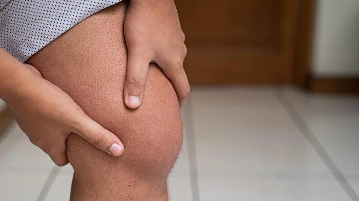 Early stage knee arthritis care in Nagpur