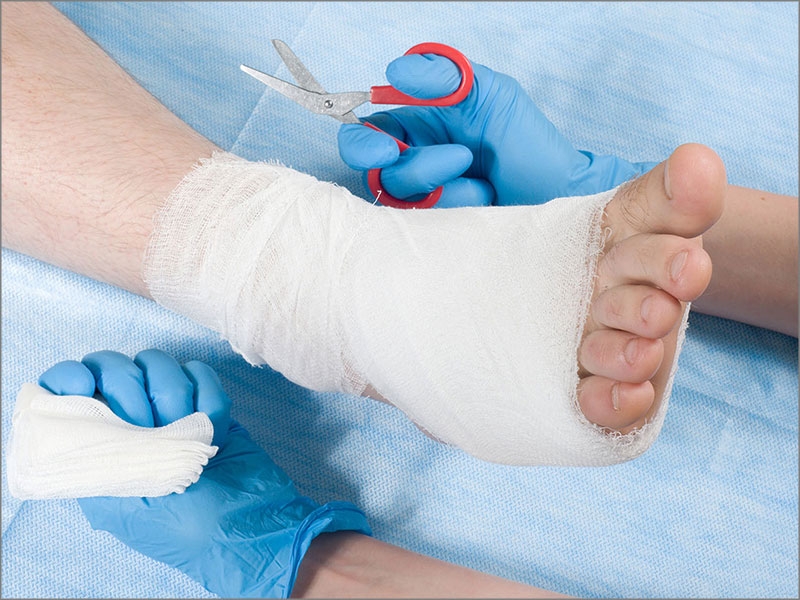 Foot reconstruction surgery in nagpur