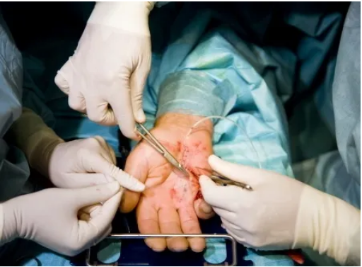 Hand surgery specialist in nagpur